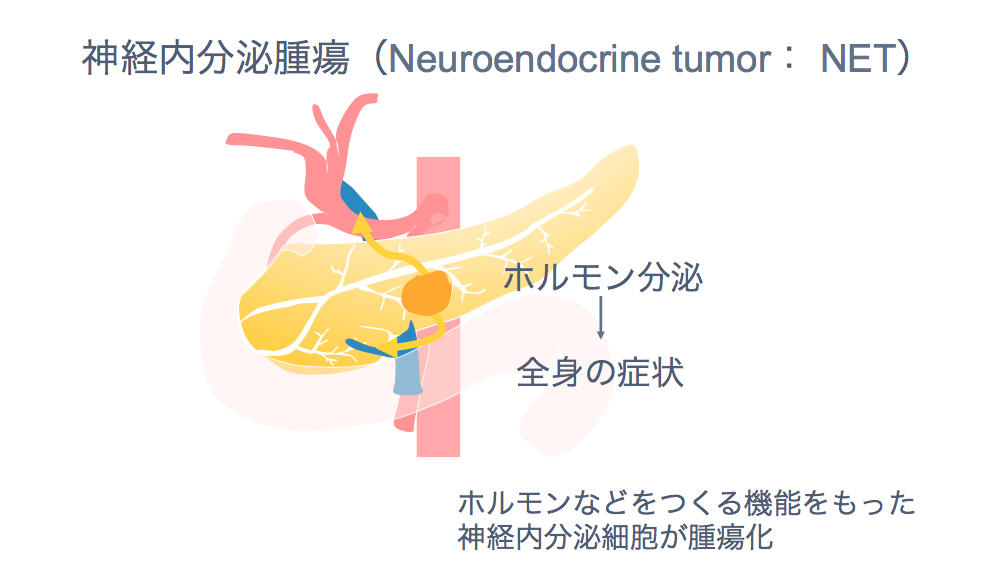 膵外分泌機能不全を模倣できるものは何ですか?